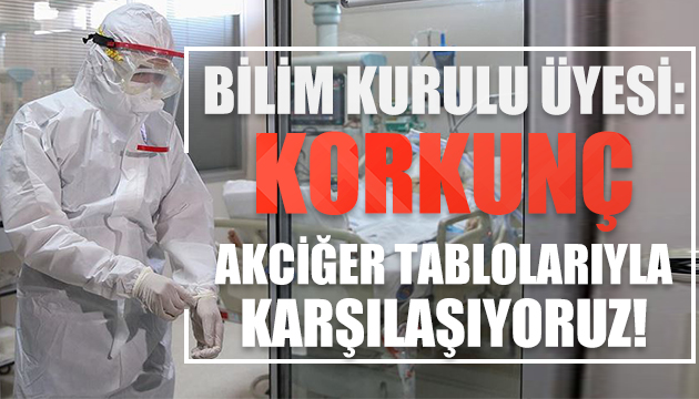 Bilim kurulu üyesi: Korkunç tablolarla karşılaşıyoruz!