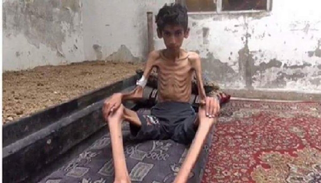 Madaya da açlıktan ölümler başladı!