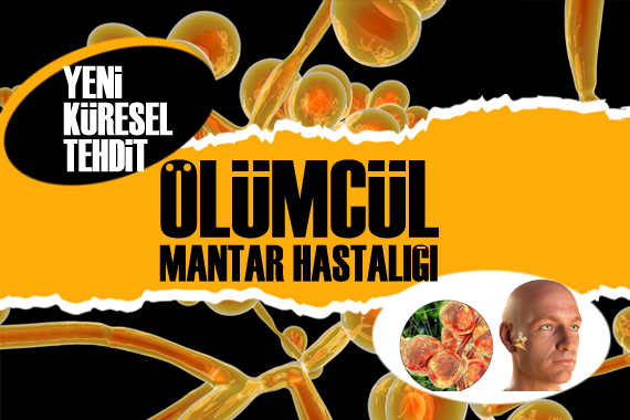 Yeni küresel tehdit: Ölümcül mantar hastalığı