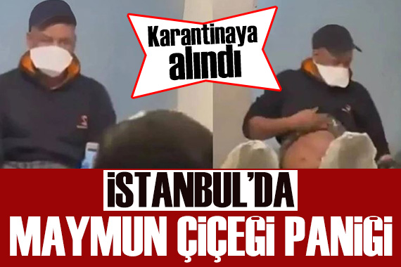 İstanbul da maymun çiçeği paniği: Karantinaya alındı