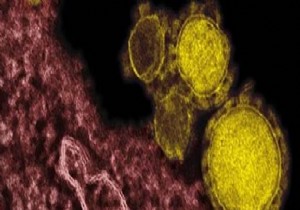 MERS virüsü nedir? MERS virüsü belirtileri nelerdir?