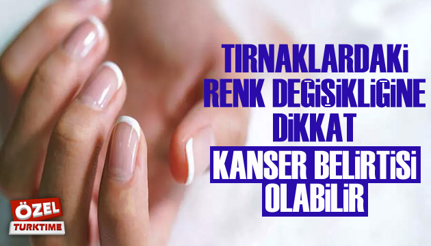 Tırnaklardaki renk değişikliğine dikkat! Kanser belirtisi olabilir