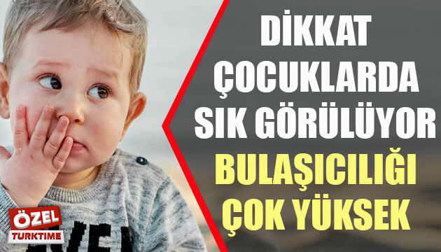 El, ayak ve ağız hastalığı nedir? Tedavisi