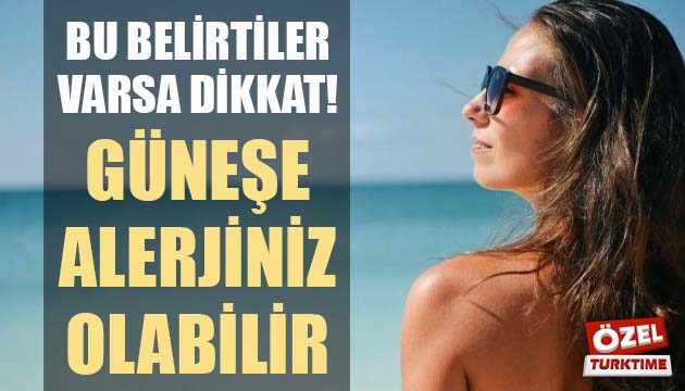 Bu belirtiler varsa dikkat! Güneşe alerjiniz olabilir