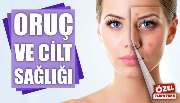 Oruç ve Cilt Sağlığı