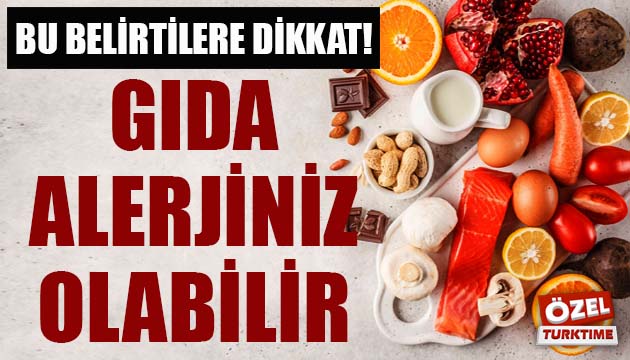 Bu belirtilere dikkat! Gıda alerjiniz olabilir