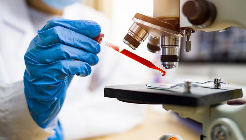 Kandaki DNA izleri kanseri haber veriyor