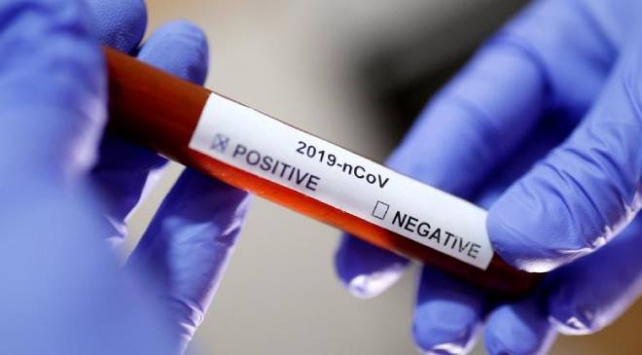 Dünya da koronavirüse yakalanan sayısı artmaya devam ediyor