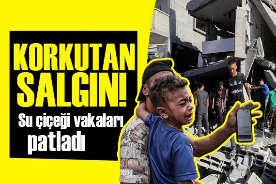 Gazze de salgın endişesi: Su çiçeği vakaları patladı