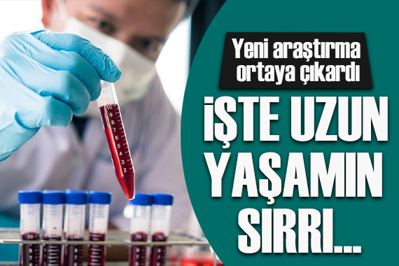 Yeni araştırma ortaya çıkardı: İşte uzun yaşamın sırrı!