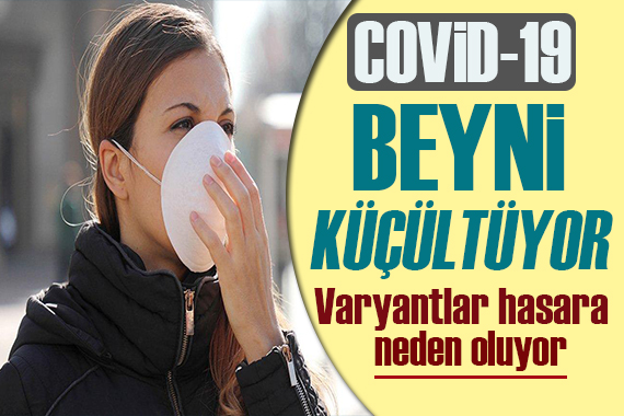 Covid-19 geçirenler dikkat! Beyin boyutunda küçülme gözlemlendi