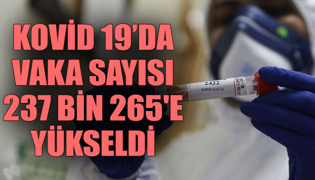 Koronavirüste can kaybı 5 bin 798 e yükseldi