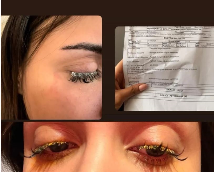 Güzellik merkezi yüzünden kör oluyordu