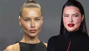 Adriana Lima'nın eski halinden eser kalmadı!
