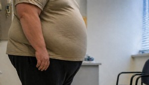 Obeziteyle ilgili çarpıcı araştırma: Kanserden koruyan mekanizma zayıflıyor!