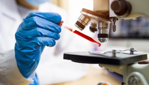 Kandaki DNA izleri kanseri haber veriyor