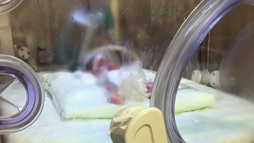 Konya da 310 gram bebek dünyaya geldi