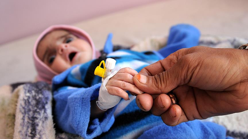  Yemen de 10 dakikada 1 çocuk ölüyor 