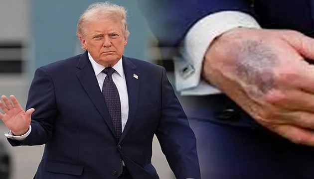 Trump, sağlık durumuna ilişkin açıklama yaptı