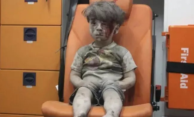 Ümran bebeğin son hali dikkat çekti