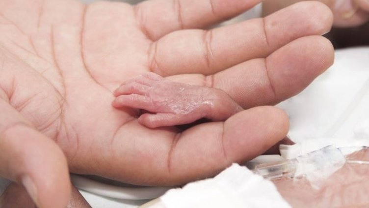 Mucize bebek: 500 gramdan daha zayıf doğdu!
