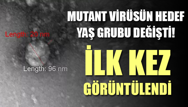 Mutant virüsün hedef yaş grubu değişti