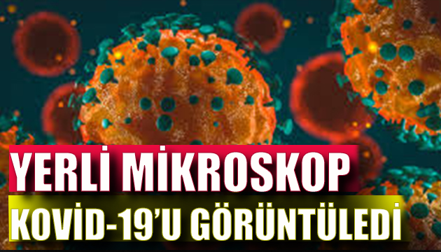 Yerli mikroskoplar Kovid-19 u görüntüledi