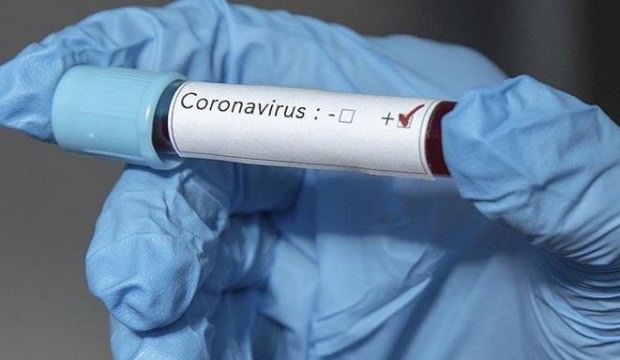 koronavirüs Türkiye